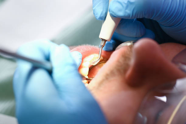 Best Urgent Dental Care for Toothache in East Marion, NY